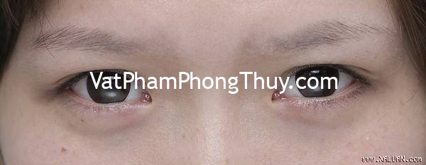 Tướng lông mày nhạt tiết lộ điều gì ở một người?