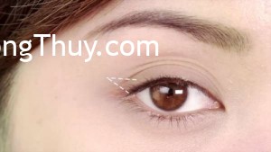 Tướng mắt 3 mí và số phận cuộc đời