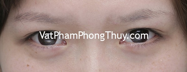 Người có hàng lông mày thưa nói lên điều gì?