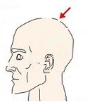 Bật mí ngay 3 vị trí nốt ruồi trên đỉnh đầu luận mệnh sang hèn