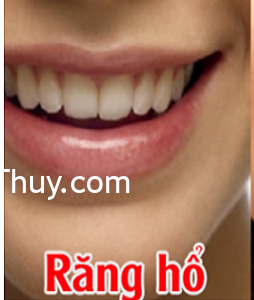 Người có tướng răng hổ tiết lộ điều gì?