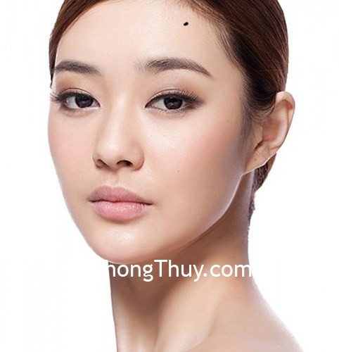 Nốt Ruồi Trên Trán